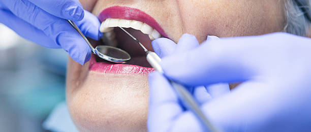 Best Walk-In Emergency Dental Services in Blacksburg, SC